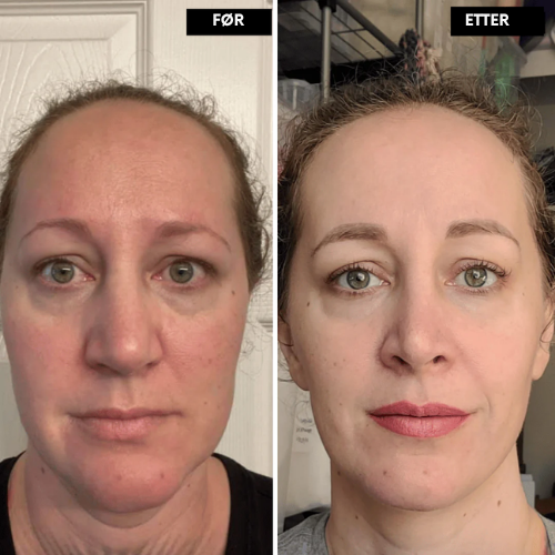 Clarivelle™ Det næste generations alternativ til retinol