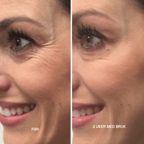 Clarivelle™ Det næste generations alternativ til retinol